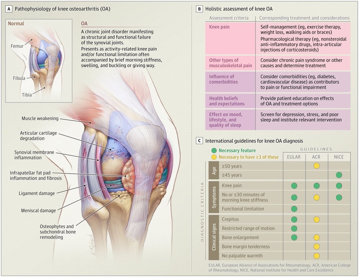 Gonalgia