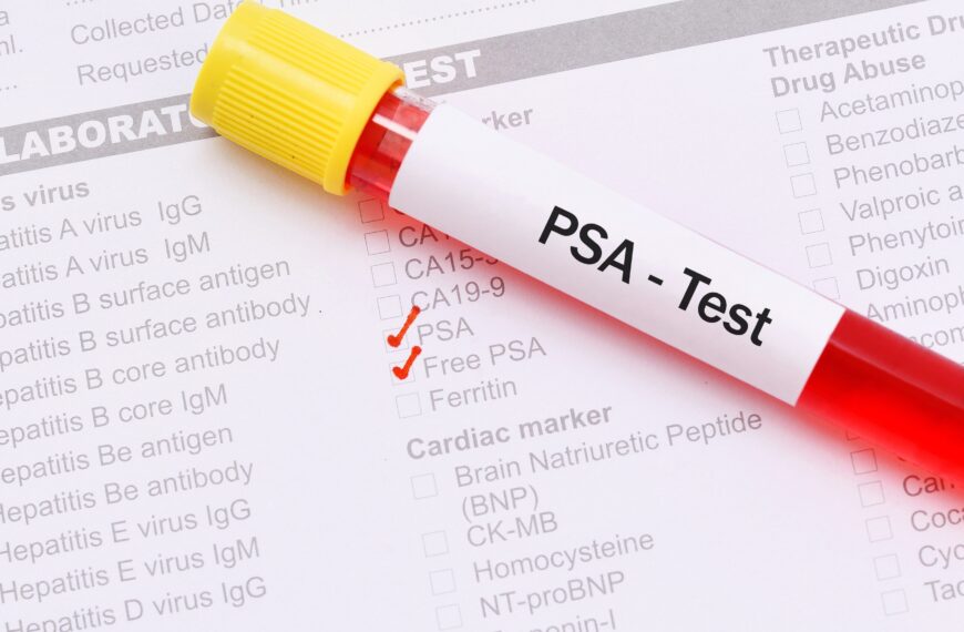 ¿Se debería seguir pidiendo PSA en personas asintomáticas?
